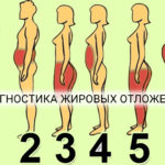 Diagnostika-zhirovyh-otlozhenij
