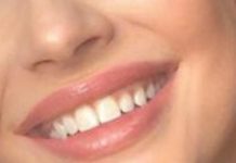 Тест: угадайте известных актрис по улыбке