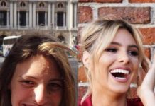 Тест: угадайте звезду по фотографии, сделанной до пластики