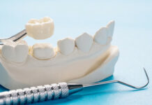 Протезирование зубов на Автозаводской