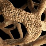 Osteoporotic bone close-up microscope view