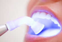 Методы отбеливания зубов