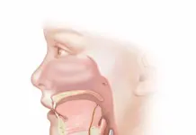 Что такое киста гортани и как она лечится