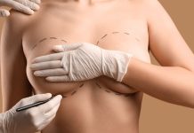 Как восстановить тело после беременности: практичный взгляд на пластику после родов