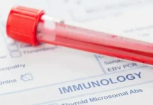Иммунограмма